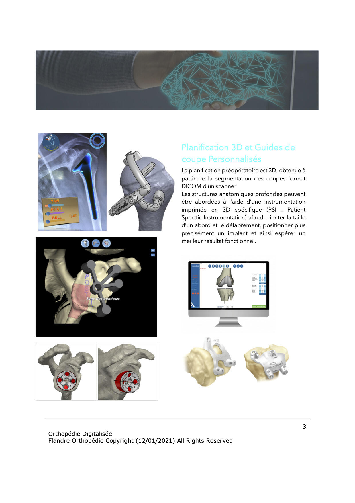 ORTHO DIGITALISEE-3 (glissees)